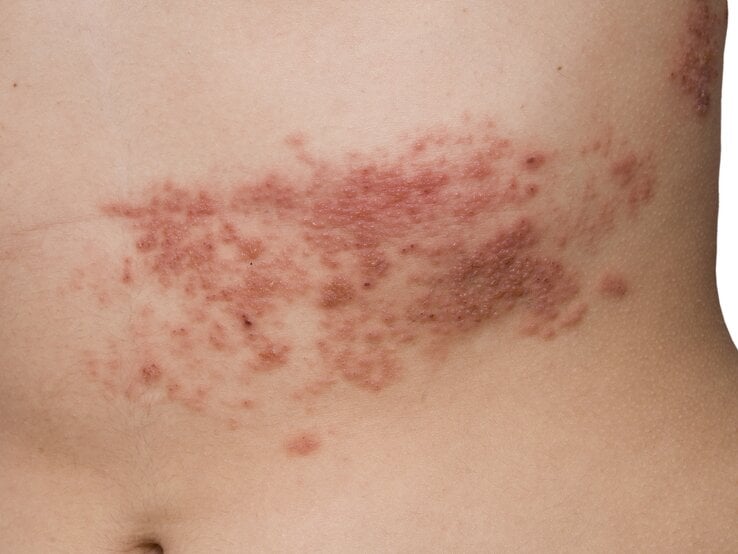 GettyImages-178635431.jpg | © Getty Images/franciscodiazpagador