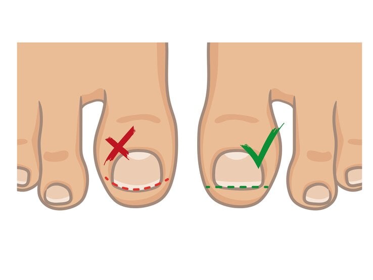 iStock-1002929956.jpg | © iStock/Sky_melody