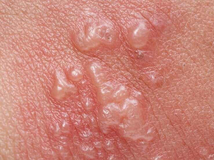 © Adobe Stock/toa555