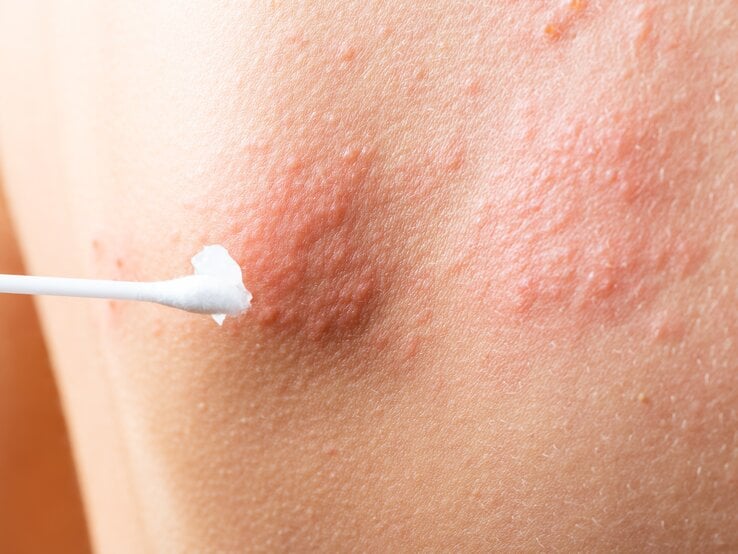 © Adobe Stock/sashka1313