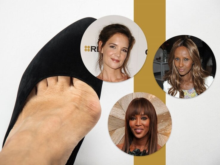 Collage, die ein Foto eines Fußes mit Hallux valgus (Ballenzeh) in einem schwarzen Schuh sowie Porträtfotos von drei prominenten Frauen darstellt, die ebenfalls unter Hallux valgus leiden könnten. Diese Frauen sind in runden Bildern dargestellt und die Collage hat eine goldene vertikale Linie als Trennlinie. | © iStock, Getty Images (3) Collage BdF Digital