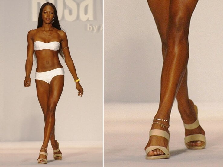 Hallux valgus Naomi Campbell | © Mark Mainz/Getty Images (Collage BdF Digital)